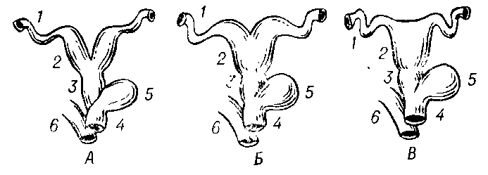 Различные типы строения матки у плацентарных млекопитающих: А - двойная; Б - двурогая; В - простая; 1 - яйцевод; 2 - матка; 3 - влагалище; 4 - мочеполовой синус; 5 - мочевой пузырь; 6 - прямая кишка.